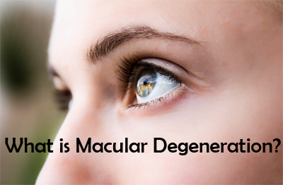 What is Macular Degeneration