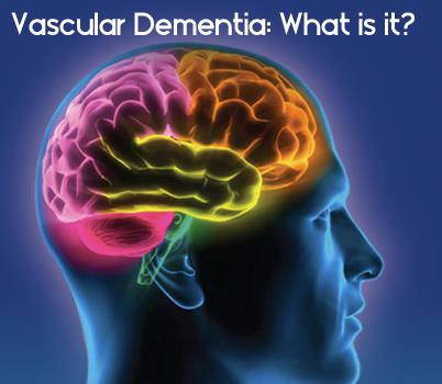 Vascular Dementia: What is it